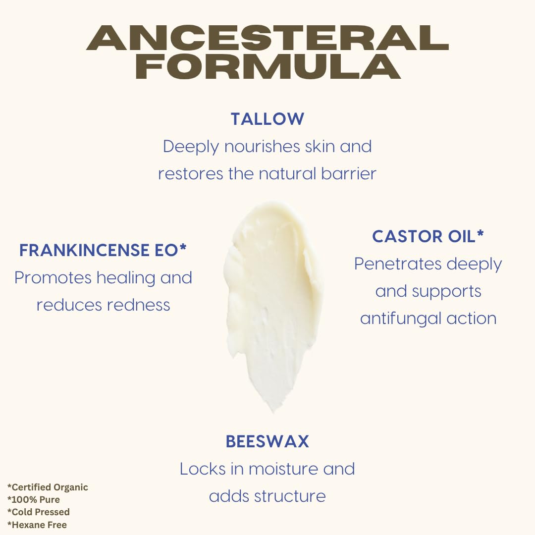 Handmade Tallow, Castor Oil, and Frankincense Oil Skin Balm - 100% Grass-Fed Tallow for Skin Care - Face & Body Moisturizer for Sensitive Skin, Eczema All-Purpose Balm - 2 FL. oz.