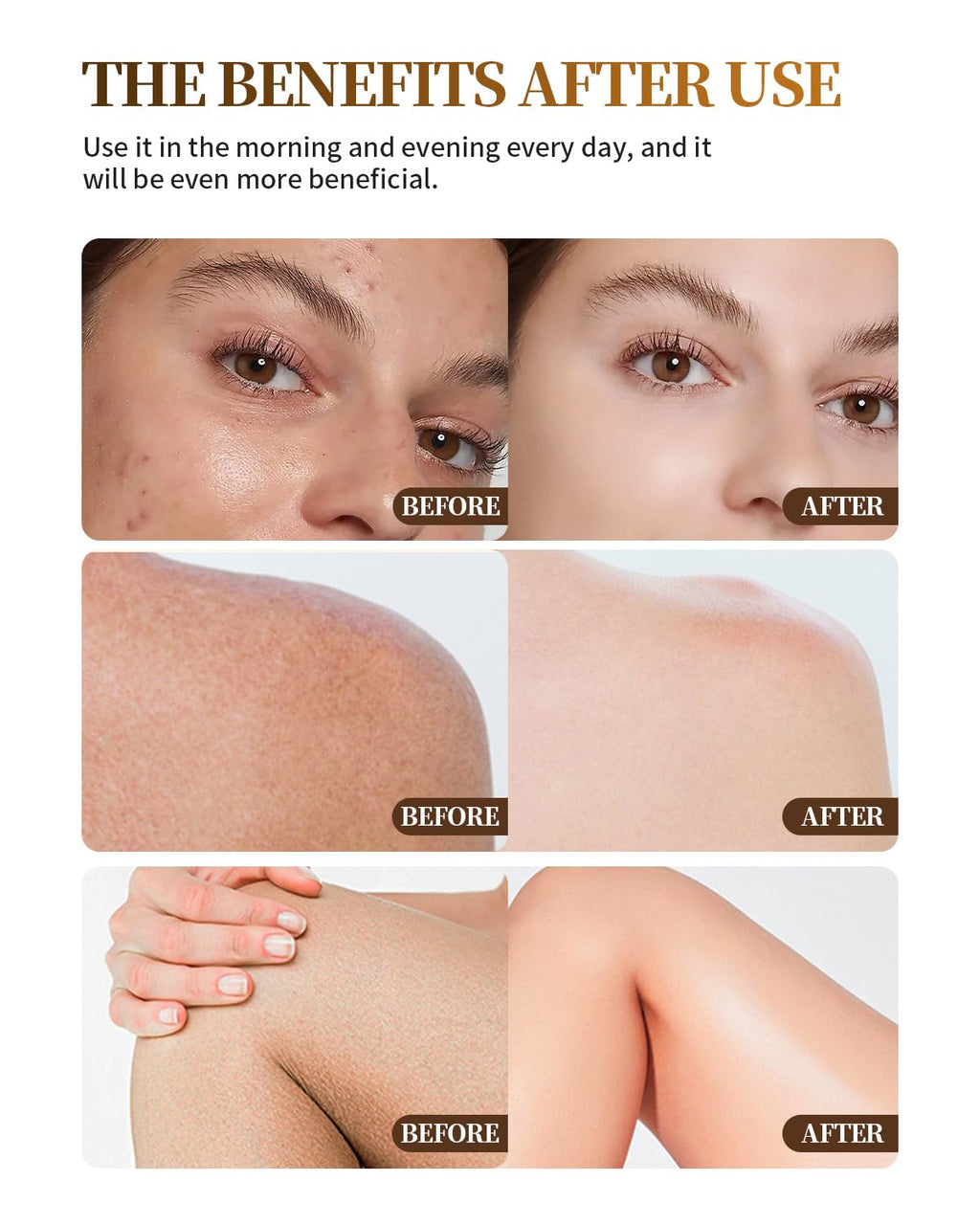 Upgraded Beef Tallow for Skin Handmade Whipped Organic Grass-Fed Tallow Balm with Raw Wild Honey for Eczema & Rosacea,Non-Comedogenic Face,Body Moisturizer for Dry, Sensitive Skin - 4oz Unscented