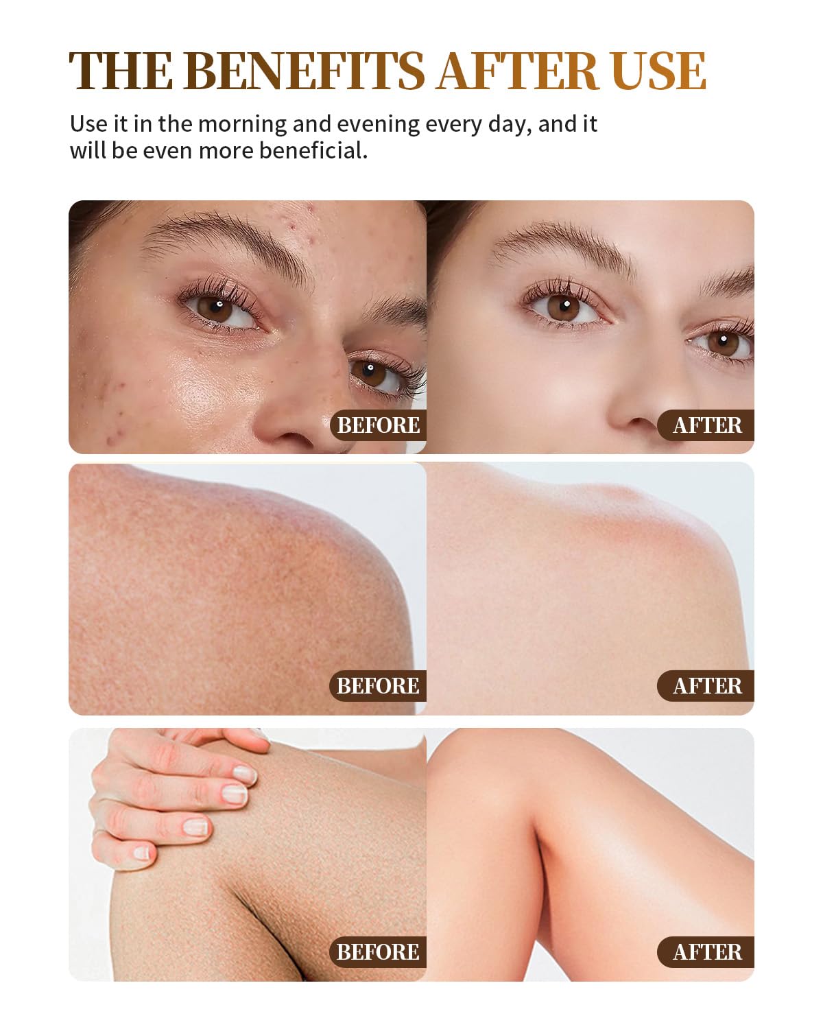 Upgraded Beef Tallow for Skin Handmade Whipped Organic Grass-Fed Tallow Balm with Raw Wild Honey for Eczema & Rosacea,Non-Comedogenic Face,Body Moisturizer for Dry, Sensitive Skin - 4oz Unscented